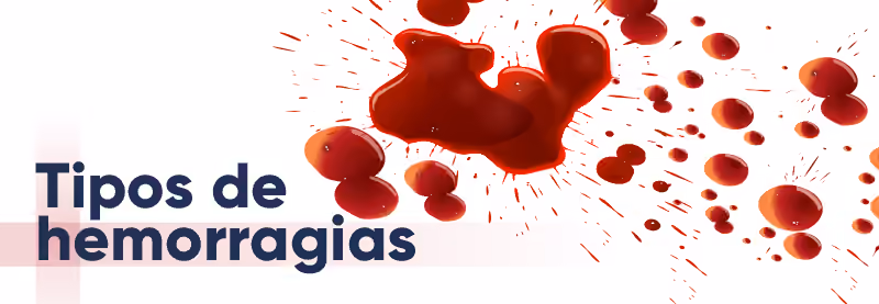Tipos de hemorragias